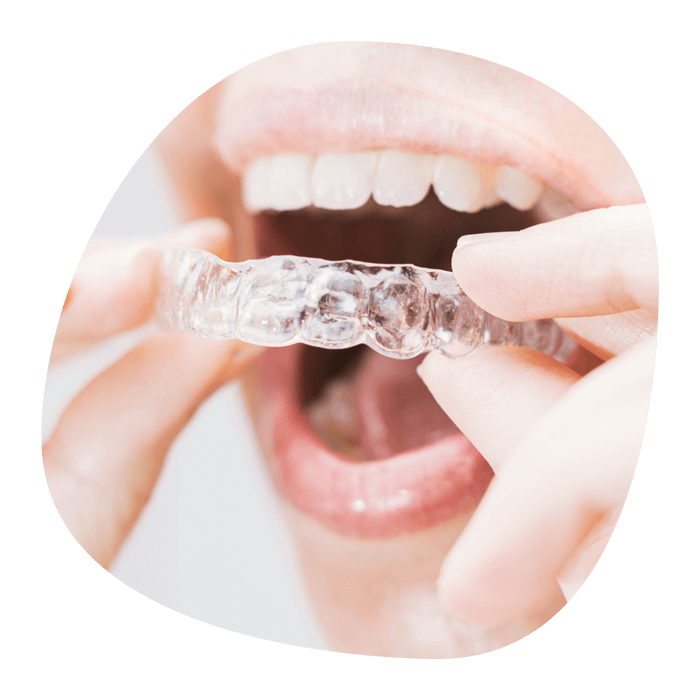 Orthodontie adulte Cergy